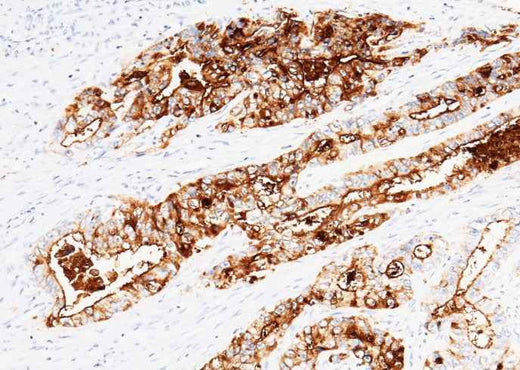 Anti-Human EGFR Antibody [B301] - ABMIUM