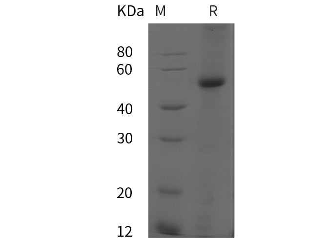 SDS-PAGE analysis of Human GLα proteins, 2 μg/lane of Recombinant Human GLα proteins was resolved with SDS-PAGE under reducing conditions, showing bands at 48 kDa.