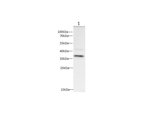 Anti-Mouse/Rat CD20 Antibody - ABMIUM