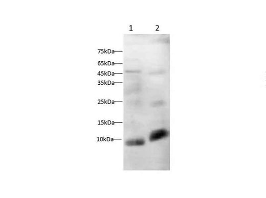 Anti-Mouse/Rat Osteocalcin Antibody - ABMIUM