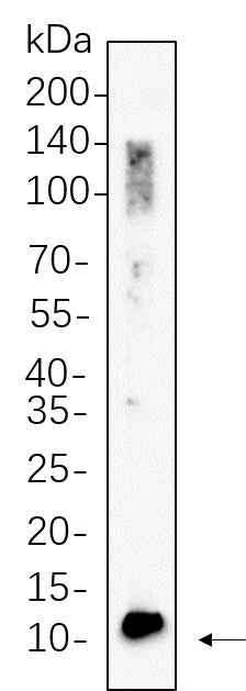Anti-Human/Mouse/Rat BDNF Antibody [B535] - ABMIUM