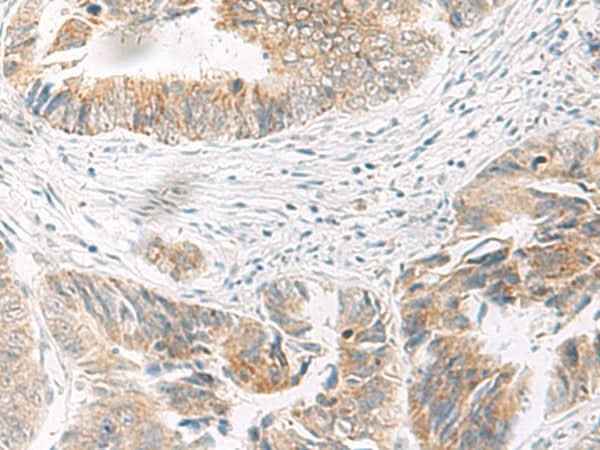 Anti-Human/Mouse IDUA Antibody
