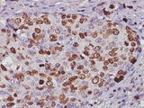 Anti-Human Ki67 Antibody [3B7] - ABMIUM