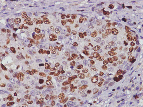 Anti-Human Ki67 Antibody [3B7] - ABMIUM