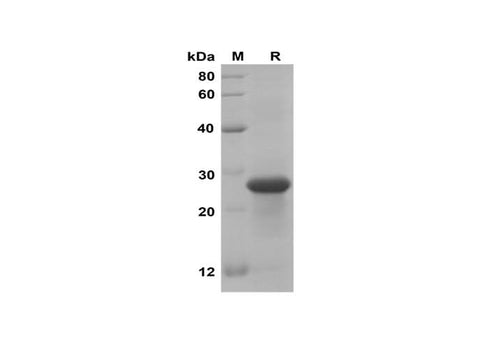 SDS-PAGE analysis of Mouse PROK1 proteins, 2 μg/lane of Recombinant Mouse PROK1 proteins was resolved with SDS-PAGE under reducing conditions, showing bands at 28 kDa.