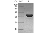 Recombinant Human DCUN1D1 Protein (His Tag) - ABMIUM