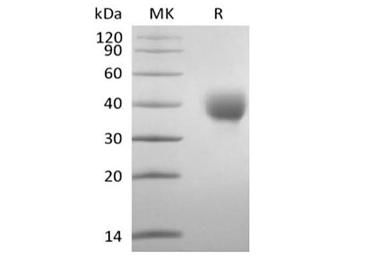 Recombinant Human Leukocyte Ig-Like Receptor A5/LILRA5/CD85f (C-6His-Avi) Biotinylated - ABMIUM