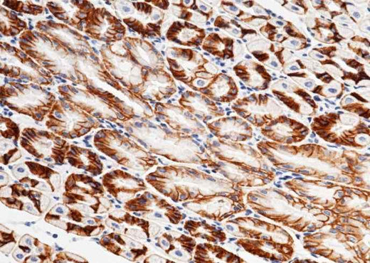 Anti-Mouse CXADR Antibody [B384] - ABMIUM