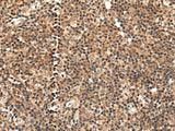 Anti-Human/Mouse/Rat C16orf45 Antibody - ABMIUM