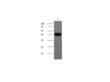 Anti-Mouse CHI3L1 Antibody - ABMIUM