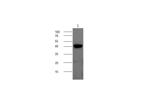 Anti-Mouse CHI3L1 Antibody - ABMIUM