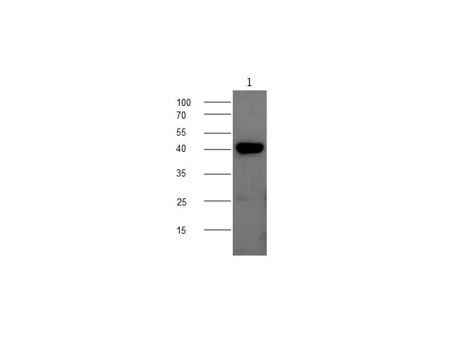 Anti-Mouse CHI3L1 Antibody - ABMIUM
