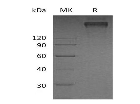Recombinant Human TRAIL R3/TNFRSF10C Protein (Fc & His Tag) - ABMIUM