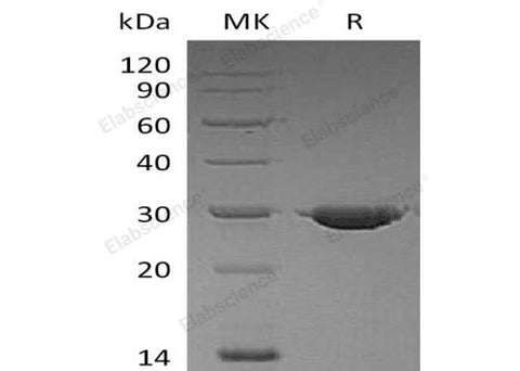 Recombinant Human PSPH Protein (His Tag) - ABMIUM