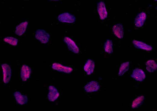 Anti-Human PPIL2 Antibody [A1244] - ABMIUM