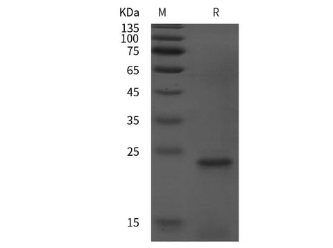 SDS-PAGE analysis of Human GADD45A proteins, 2 μg/lane of Recombinant Human GADD45A proteins was resolved with SDS-PAGE under reducing conditions, showing bands at 23 kDa.