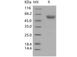 Recombinant Human Podoplanin/PDPN Protein (His & Fc Tag) - ABMIUM
