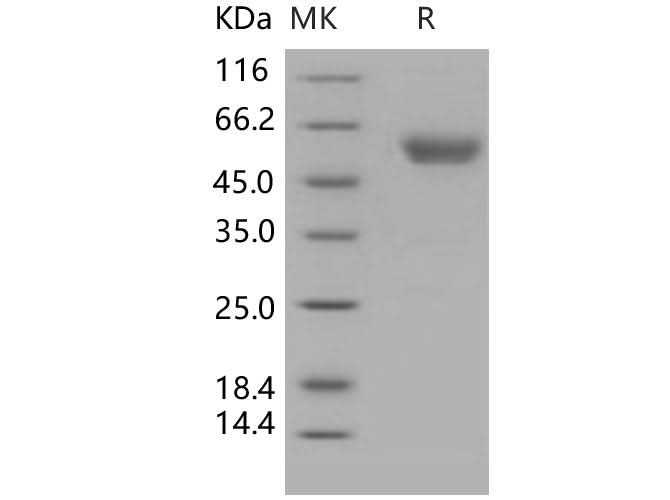 Recombinant Human Podoplanin/PDPN Protein (His & Fc Tag) - ABMIUM