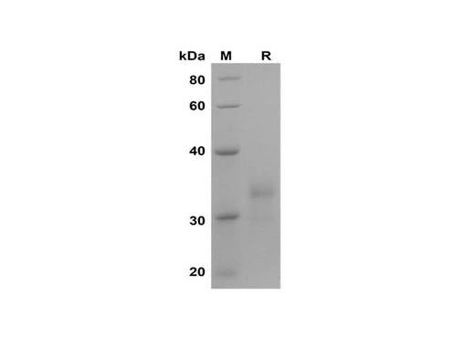 SDS-PAGE analysis of Human IL-29 proteins, 2 μg/lane of Recombinant Human IL-29 proteins was resolved with SDS-PAGE under reducing conditions, showing bands at 34 kDa.