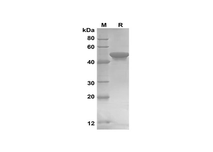 SDS-PAGE analysis of Human GCLC proteins,2 μg/lane of Recombinant Human GCLC proteins,was resolved with SDS-PAGE under reducing conditions,showing bands at 47 kDa.