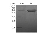 Recombinant Mouse CTLA4 Protein (Fc Tag) - ABMIUM