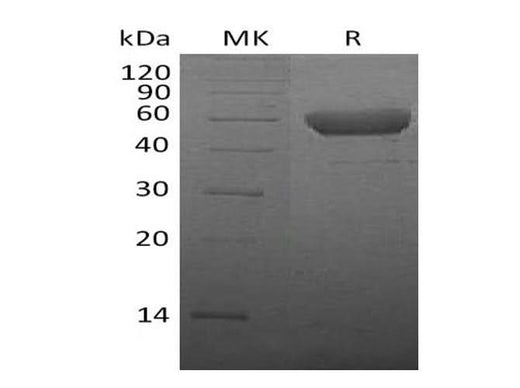 Recombinant Mouse CTLA4 Protein (Fc Tag) - ABMIUM