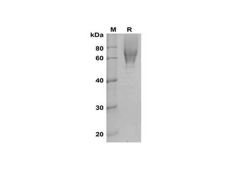 SDS-PAGE analysis of Mouse Ceacam1 proteins, 2 μg/lane of Recombinant Mouse Ceacam1 proteins was resolved with SDS-PAGE under reducing conditions, showing bands at 55-80 kDa.