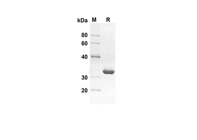 SDS-PAGE analysis of Human PFN1 proteins, 2 μg/lane of Recombinant Human PFN1 proteins was resolved with an SDS-PAGE under reducing conditions, showing bands at 28.3 kDa.