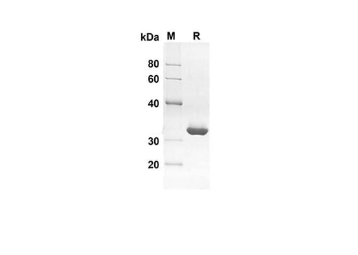 SDS-PAGE analysis of Human PFN1 proteins, 2 μg/lane of Recombinant Human PFN1 proteins was resolved with an SDS-PAGE under reducing conditions, showing bands at 28.3 kDa.