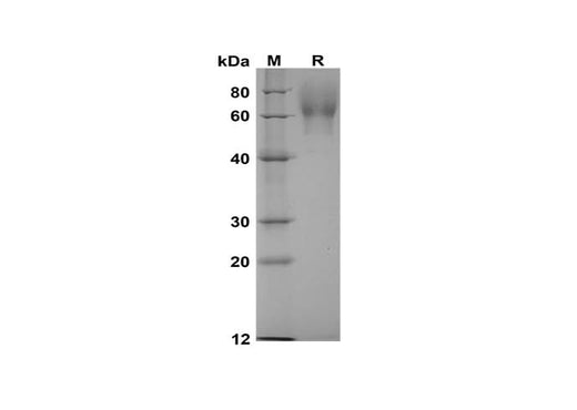 SDS-PAGE analysis of Rat TrkB/NTRK2 proteins, 2 μg/lane of Recombinant Rat TrkB/NTRK2 proteins was resolved with SDS-PAGE under reducing conditions, showing bands at 60 kDa.