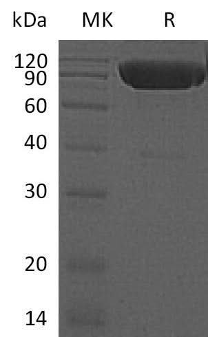 Recombinant Mouse DR6/TNFRSF21 Protein (His Tag) - ABMIUM