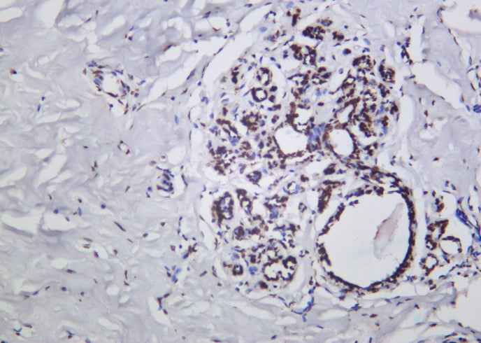 Anti-Human/Mouse/Rat p53 Antibody [B1014]