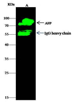 Anti-Human AFP Antibody [A1140] - ABMIUM