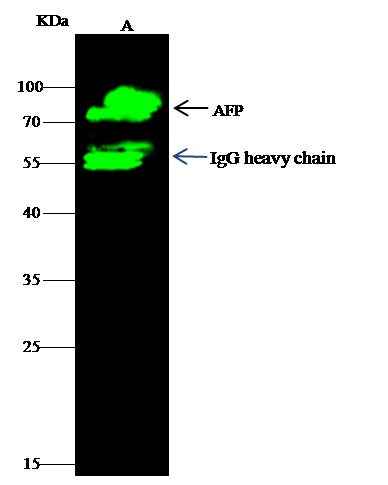 Anti-Human AFP Antibody [A1140] - ABMIUM