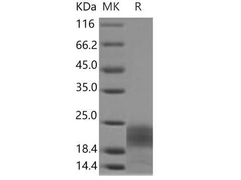 Recombinant Human PDGF-BB Protein (His Tag) - ABMIUM