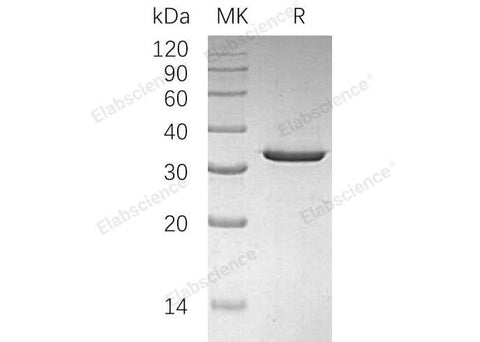 Recombinant Human Sulfotransferase 4A1/SULT4A1 Protein - ABMIUM