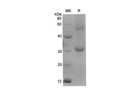 SDS-PAGE analysis of Rat KLK6 proteins, 2 μg/lane of Recombinant Rat KLK6 proteins was resolved with SDS-PAGE under reducing conditions, showing bands at 28.62 kDa.