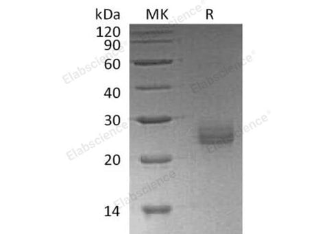 Recombinant Human Ephrin-A1/EFNA1 Protein (His Tag) - ABMIUM