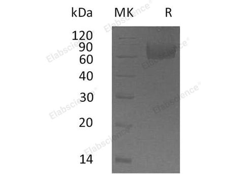 Recombinant Human IL18BP Protein (Fc Tag) - ABMIUM