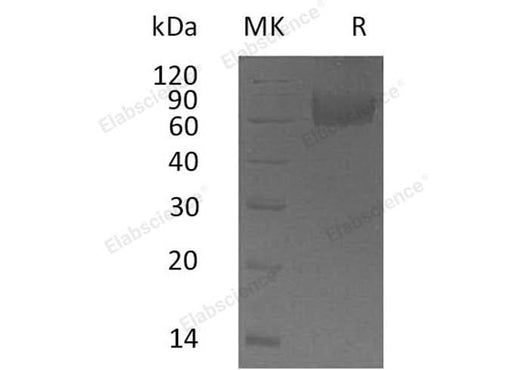 Recombinant Human IL18BP Protein (Fc Tag) - ABMIUM
