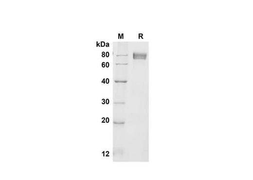 SDS-PAGE analysis of Mouse CD14 proteins , 2 μg/lane of Recombinant Mouse CD14 proteins was resolved with SDS-PAGE under reducing conditions , showing bands at 80 kDa.