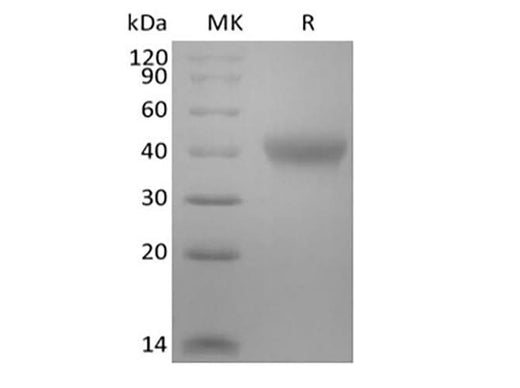 Recombinant Mouse TNF Receptor II/TNF RII/TNFRSF1B/CD120b (C-6His-Avi) Biotinylated - ABMIUM