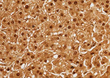Anti-Human ARG1 Antibody [B329]