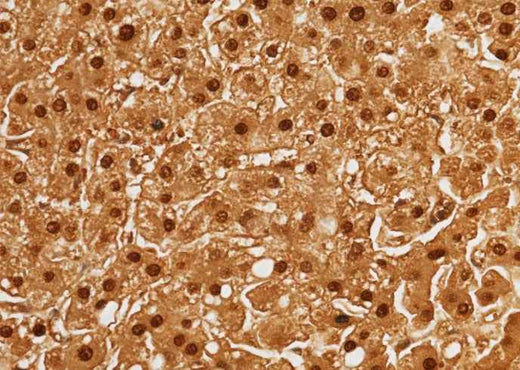 Anti-Human ARG1 Antibody [B329] - ABMIUM