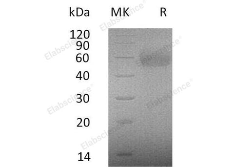 Recombinant Human IL2RG/CD132 Protein (Fc & His Tag) - ABMIUM