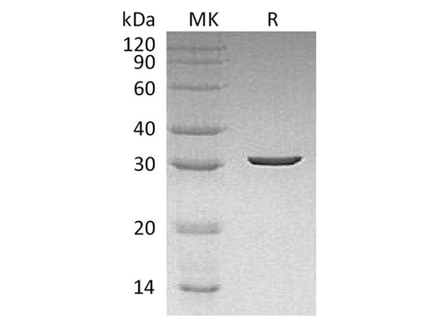 Recombinant Dechloromonas aromatica Chlorite Dismutase Protein (His Tag) - ABMIUM