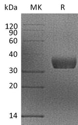 Recombinant Mouse MGL2/CD301b Protein (His Tag) - ABMIUM