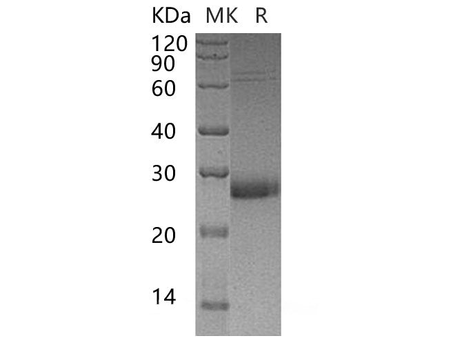 Recombinant Human Uroplakin-2/UPK2 Protein (His Tag) - ABMIUM