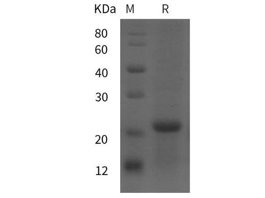 SDS-PAGE analysis of Rat CRH proteins, 2 μg/lane of Recombinant Rat CRH proteins was resolved with SDS-PAGE under reducing conditions, showing bands at 21 kDa.