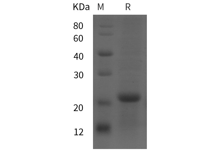 SDS-PAGE analysis of Rat CRH proteins, 2 μg/lane of Recombinant Rat CRH proteins was resolved with SDS-PAGE under reducing conditions, showing bands at 21 kDa.